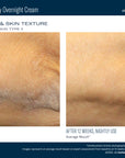 AlphaRet Body Overnight Cream