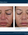 Mystro Active Balance Serum