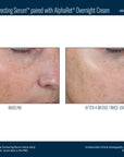 Even Tone Correcting Serum