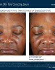 Even Intensive Skin Tone Correcting Serum