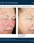 Even Intensive Skin Tone Correcting Serum