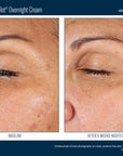 EyeMax AlphaRet Overnight Cream
