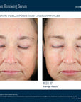 Mystro Revive Renewing Serum